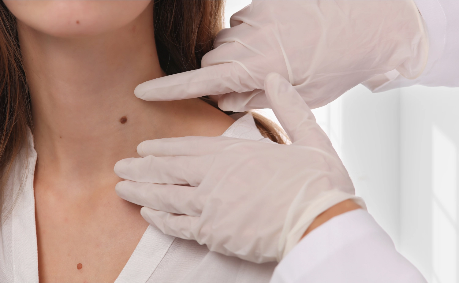 skin tag and mole removal | Aesthetify | Watchung, NJ | New York, NY