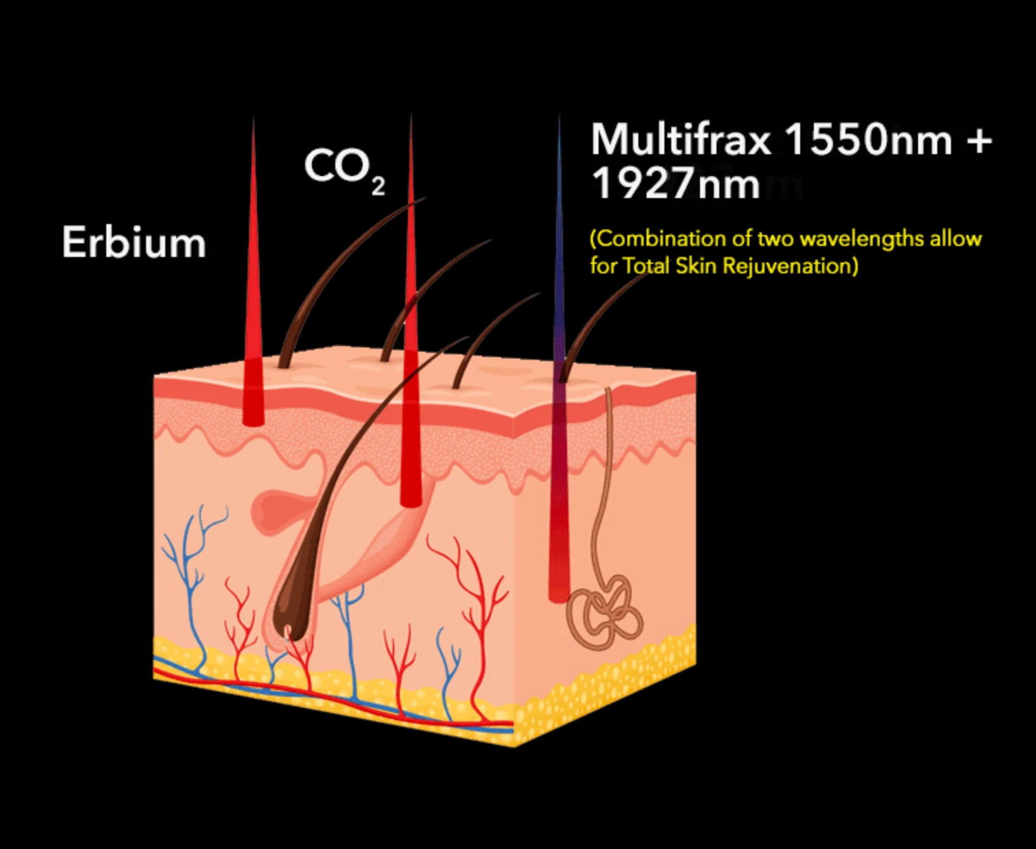 Multifrax™ product b